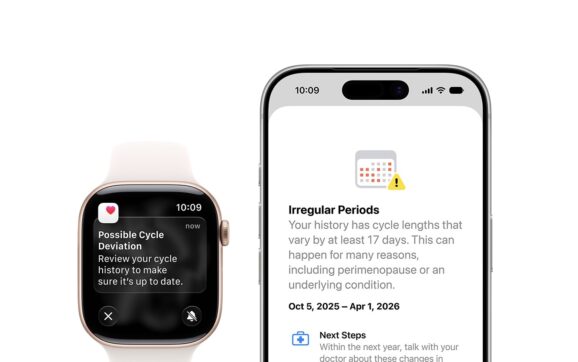 watchOS 27: Apple Watch bước sang kỷ nguyên AI với Siri AI và trải nghiệm “ngữ cảnh hóa” sâu hơn