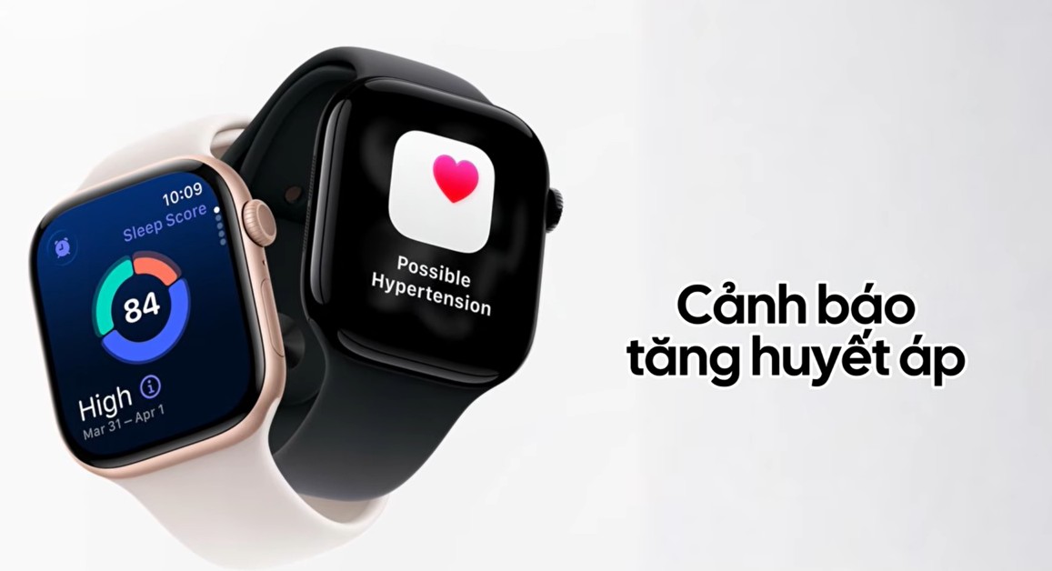Apple Watch Series 12